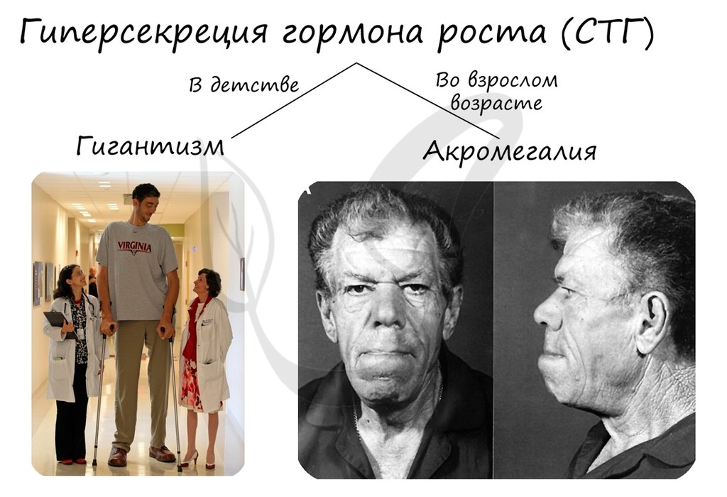 Слайд 14 — иллюстрация к презентации «Гуморальная регуляция и эндокринная система» по биологии для 11 класса